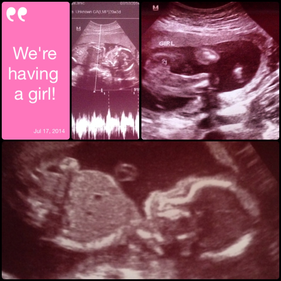 baby girl's ultrasound at 20 weeks
